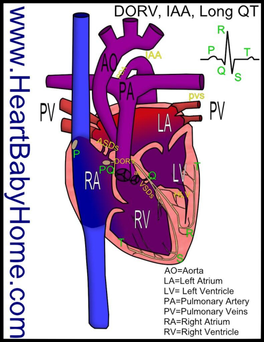 10-surprising-famous-people-with-williams-syndrome.jpg 10 Surprising Famous People with Williams Syndrome