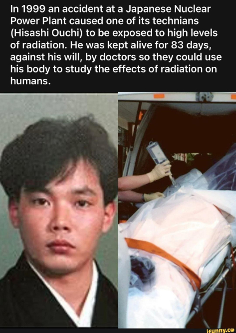the-tragic-story-of-hisashi-ouchi-and-japans-radiation-burns.jpg The Tragic Story of Hisashi Ouchi and Japan’s Radiation Burns