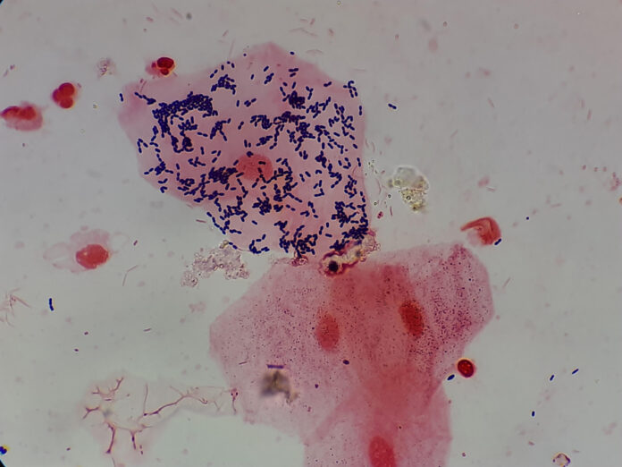 Exploring Pus Videos: Unveiling Insights into a Unique Medical Phenomenon