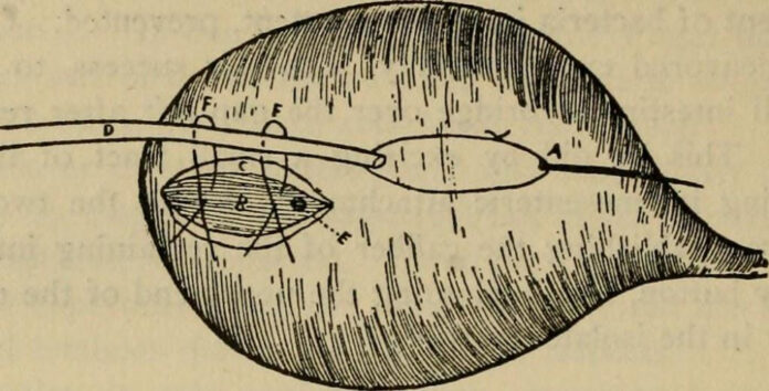 The Lateral Suture Dog Surgery: A Comprehensive Guide